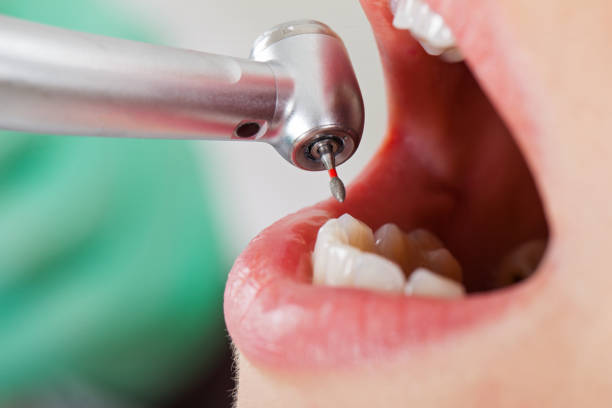 Best Same-Day Emergency Dentist in Citrus Springs, FL